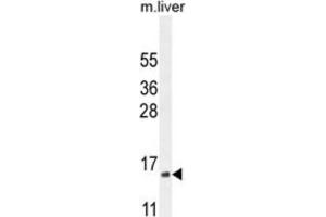 Western Blotting (WB) image for anti-Complexin 3 (CPLX3) antibody (ABIN2995755) (CPLX3 antibody)