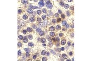 Image no. 1 for anti-Chemokine (C-X3-C Motif) Receptor 1 (CX3CR1) antibody (ABIN203578) (CX3CR1 antibody)