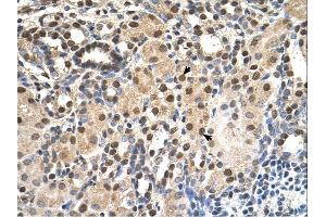 ANP32E antibody was used for immunohistochemistry at a concentration of 4-8 ug/ml. (ANP32E antibody)
