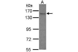 WB Image Sample (30 ug of whole cell lysate) A: IMR32 7. (AKAP1 antibody  (C-Term))