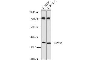 Western blot analysis of extracts of various cell lines, using CLVS2 antibody (ABIN7266410) at 1:1000 dilution. (CLVS2 antibody  (AA 265-327))