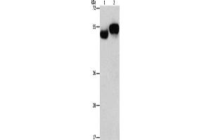 Western Blotting (WB) image for anti-Archaelysin Family Metallopeptidase 1 (AMZ1) antibody (ABIN2432514) (AMZ1 antibody)