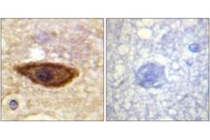 Immunohistochemistry analysis of paraffin-embedded human brain tissue, using Interferon-alpha/beta Receptor alpha chain (Ab-466) Antibody. (IFNAR1 antibody  (AA 436-485))