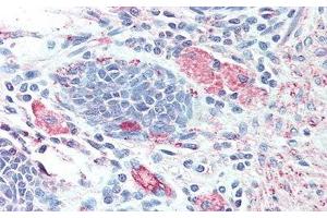 Detection of HEXb in Human Colon Tissue using Polyclonal Antibody to Hexosaminidase B Beta (HEXb) (HEXB antibody  (AA 101-217))