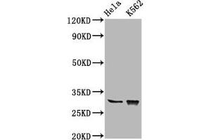 Western Blot Positive WB detected in: Hela whole cell lysate, K562 whole cell lysate All lanes: CHODL antibody at 6. (CHODL antibody  (AA 105-206))
