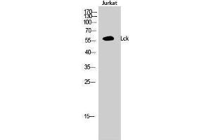 Western Blotting (WB) image for anti-Lymphocyte-Specific Protein tyrosine Kinase (LCK) (Ser736) antibody (ABIN3185366) (LCK antibody  (Ser736))