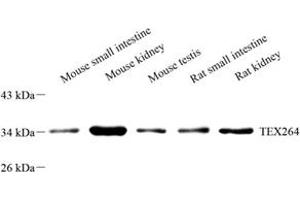 Western blot analysis of TEX264 (ABIN7075863) at dilution of 1: 2000 (TEX264 antibody)