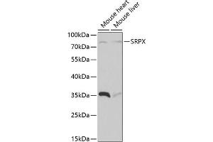 Western blot analysis of extracts of various cell lines, using SRPX antibody  at 1:1000 dilution. (SRPX antibody  (AA 40-320))