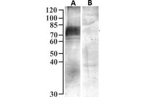 ABIN7013885 (1 μg/mL) staining of isolated Brush Border Membranes from Human Kidney (75 μg protein) with (B) and without (A) blocking with the immunizing peptide. (SLC5A1 antibody  (Internal Region))