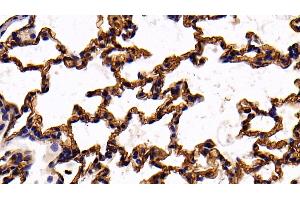 Detection of ACE in Mouse Lung Tissue using Polyclonal Antibody to Angiotensin I Converting Enzyme (ACE) (Angiotensin I Converting Enzyme 1 antibody  (AA 334-409))