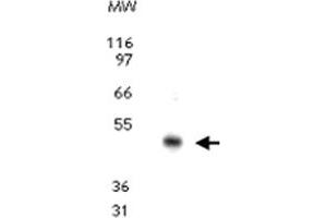 Western blot analysis for CCR10. (CCR10 antibody  (AA 350-362))