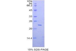 SDS-PAGE (SDS) image for Paraoxonase 1 (PON1) (AA 187-354) protein (His tag) (ABIN2121819)