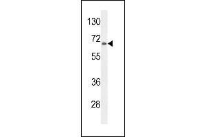 Western blot analysis of lysate from HepG2 cell line, using AGXT2 Antibody (C-term) (ABIN653791 and ABIN2843075). (AGXT2 antibody  (C-Term))