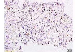 Formalin-fixed and paraffin embedded rat colon labeled with Anti-FOXJ1/HFH-4 Polyclonal Antibody, Unconjugated (ABIN734288) at 1:200 followed by conjugation to the secondary antibody and DAB staining. (FOXJ1 antibody  (AA 161-260))