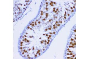 Immunohistochemistry (IHC) image for anti-Kinesin Family Member 2C (KIF2C) (AA 531-725) antibody (ABIN3043278)