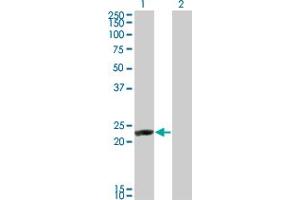 Western Blot analysis of RCV1 expression in transfected 293T cell line by RCV1 monoclonal antibody (M14), clone 1B7.