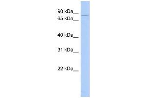 WB Suggested Anti-CHM Antibody Titration:  0. (CHM antibody  (N-Term))