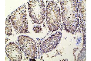 Immunohistochemistry (IHC) image for anti-Ephrin B2 (EFNB2) (C-Term) antibody (ABIN6261455)