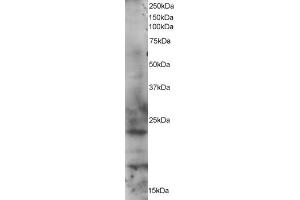 ABIN184568 staining (1µg/ml) of HeLa lysate (RIPA buffer, 35µg total protein per lane). (RAB2A antibody  (C-Term))