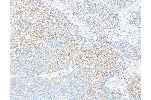 Immunohistochemistry (IHC) image for anti-RNA Binding Motif Protein 9 (RBM9) (AA 1-50) antibody (ABIN7454680) (RBM9 antibody  (AA 1-50))