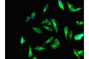 anti-PET100 Homolog (PET100) (AA 26-73) antibody