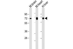 All lanes : Anti-PGM1 Antibody (C-Term) at 1:2000 dilution Lane 1: mouse brain lysates Lane 2: mouse heart lysates Lane 3: human liver lysates Lysates/proteins at 20 μg per lane. (Phosphoglucomutase 1 antibody  (AA 469-501))