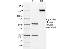 SDS-PAGE Analysis Purified CDC20 Mouse Monoclonal Antibody (AR12). (CDC20 antibody)