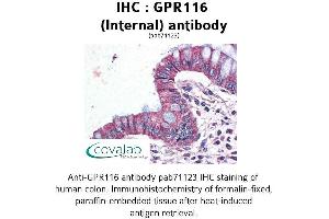 Image no. 1 for anti-G Protein-Coupled Receptor 116 (GPR116) (Internal Region) antibody (ABIN1734909) (G Protein-Coupled Receptor 116 antibody  (Internal Region))