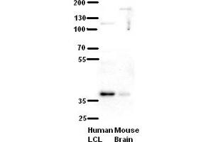 WB Suggested Anti-C21orf59 Antibody Titration:  5% Milk  ELISA Titer:  dilution: 1:500  Positive Control:  human LCL and mouse brains (C21orf59 antibody  (N-Term))