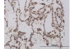 Immunoperoxidase of monoclonal antibody to FOXL1 on formalin-fixed paraffin-embedded human lung. (FOXL1 antibody  (AA 132-240))