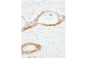 Immunohistochemistry (IHC) image for anti-Cellular Retinoic Acid Binding Protein 2 (CRABP2) (C-Term) antibody (ABIN7454522) (CRABP2 antibody  (C-Term))