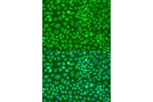 Immunofluorescence analysis of U2OS cells using DN antibody (ABIN6127820, ABIN6139729, ABIN6139731 and ABIN6224283) at dilution of 1:100. (DNAL1 antibody  (AA 41-190))