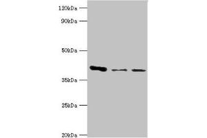 Western blot All lanes: E3 Ribonucleoside-diphosphate reductase subunit M2 B antibody at 6 μg/mL Lane 1: MCF-7 whole cell lysate Lane 2: Hela whole cell lysate Lane 3: HepG2 whole cell lysate Secondary Goat polyclonal to rabbit IgG at 1/10000 dilution Predicted band size: 41, 35, 16, 8, 5, 49 kDa Observed band size: 41 kDa