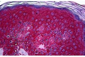 Human Skin: Formalin-Fixed, Paraffin-Embedded (FFPE) (KIT antibody  (AA 41-140))