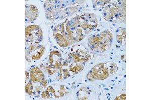 Immunohistochemistry of paraffin-embedded human stomach using IMPA1 antibody (ABIN2563424) at dilution of 1:100 (40x lens). (IMPA1 antibody)