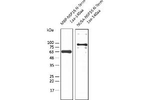Western Blotting (WB) image for anti-SARS-CoV-2 2'-O-Ribose Methyltransferase (NSP16) (N-Term) antibody (ABIN7273008) (SARS-CoV-2 NSP16 antibody  (N-Term))