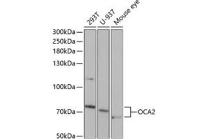 Western blot analysis of extracts of various cell lines, using OC antibody (ABIN6132880, ABIN6144989, ABIN6144990 and ABIN6221296) at 1:1000 dilution. (OCA2 antibody  (AA 1-180))