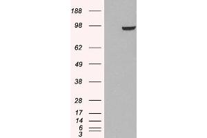HEK293 overexpressing PDE5A (ABIN5454320) and probed with ABIN185350 (mock transfection in first lane).