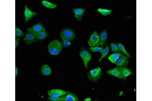 Immunofluorescent analysis of HepG2 cells using ABIN7153147 at dilution of 1:100 and Alexa Fluor 488-congugated AffiniPure Goat Anti-Rabbit IgG(H+L) (FXR1 antibody  (AA 469-614))