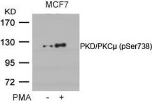 Western blot analysis of extracts from MCF cells untreated or treated with PMA using PKD/PKCm(Phospho-Ser738) Antibody. (PKC mu antibody  (pSer738))