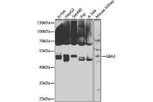 Western blot analysis of extracts of various cell lines, using GB antibody (ABIN6131369, ABIN6140990, ABIN6140991 and ABIN6223796) at 1:1000 dilution. (GBA3 antibody  (AA 1-162))