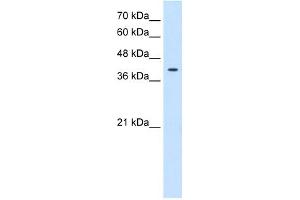 Tetraspanin 12 antibody used at 0. (TSPAN12 antibody  (Middle Region))