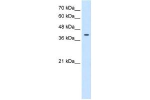 Tetraspanin 12 antibody used at 0. (TSPAN12 antibody  (Middle Region))
