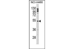 Image no. 1 for anti-B-Cell Linker (BLNK) (Middle Region) antibody (ABIN452784) (B-Cell Linker antibody  (Middle Region))