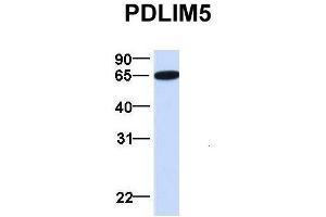 Host:  Rabbit  Target Name:  PDLIM5  Sample Type:  Human Fetal Brain  Antibody Dilution:  1. (PDLIM5 antibody  (N-Term))