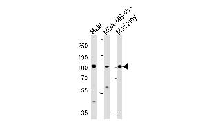 NCOA7 Antibody (N-term) (ABIN653488 and ABIN2842907) western blot analysis in Hela,MDA-MB-453 cell line and mouse kidney tissue lysates (35 μg/lane). (NCOA7 antibody  (N-Term))