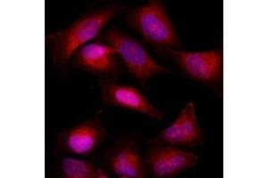 Immunofluorescenitrocellulosee of HeLa cells stained with Hoechst 3342 (Blue) for nucleus staining and with monoclonal anti-human Bcl-2 antibody (1:500) with Texas Red (Red). (Bcl-2 antibody  (AA 1-211))