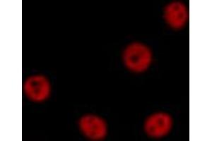 ABIN6269312 staining HeLa by IF/ICC. (MEF2A antibody  (Internal Region))