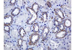 Image no. 1 for anti-Cadherin 1, Type 1, E-Cadherin (Epithelial) (CDH1) antibody (ABIN1497941) (E-cadherin antibody)