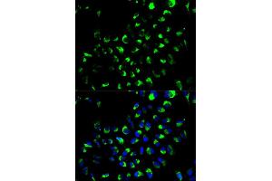 Immunofluorescence analysis of A549 cells using AK4 antibody (ABIN6290046).